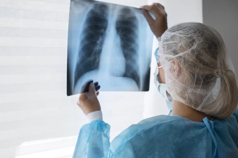 Cáncer de pulmón: causas principales y su relación con el tabaquismo